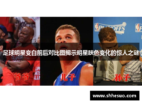 足球明星变白前后对比图揭示明星肤色变化的惊人之谜